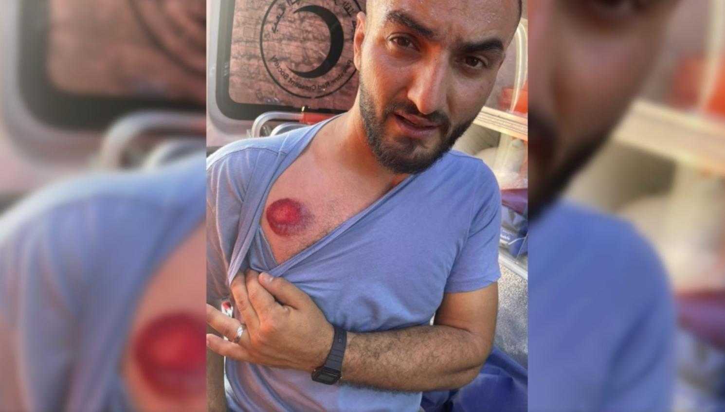 GJC: Journalists are targeted in Jerusalem, where is the international community?